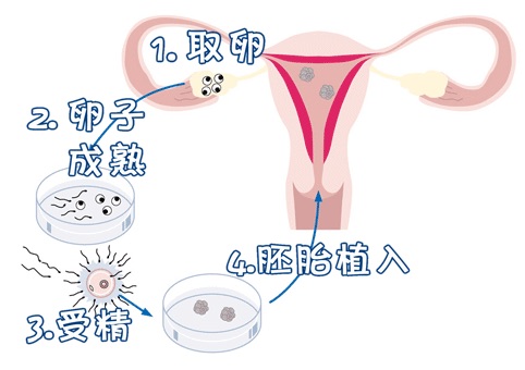 培养室